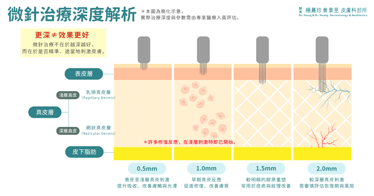 微針治療深度解析