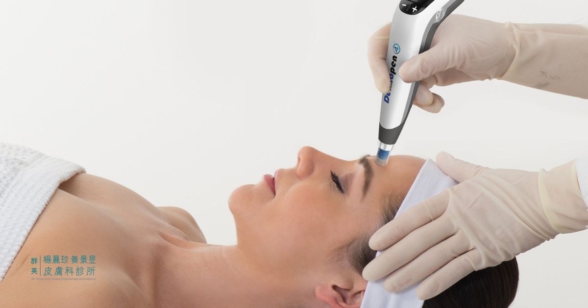 Dermapen 微針筆是什麼