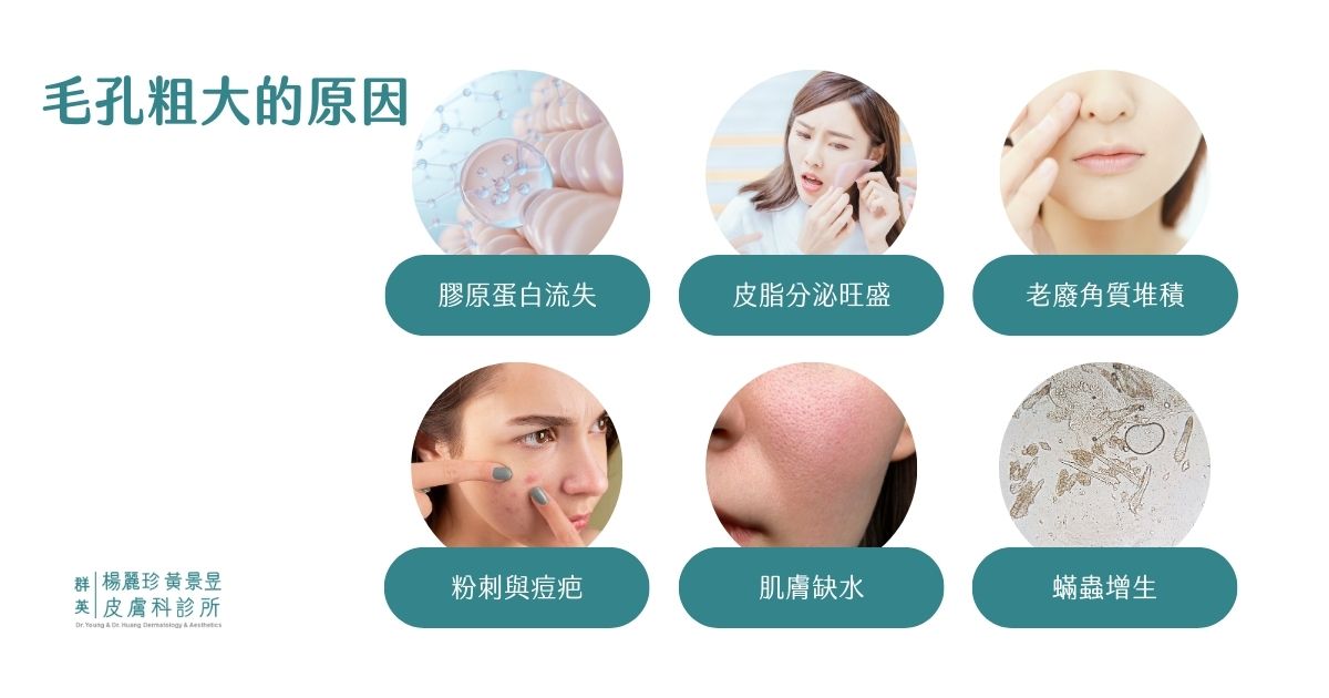 毛孔粗大原因