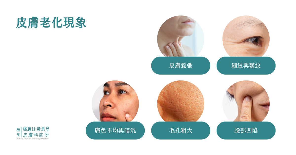 皮膚老化