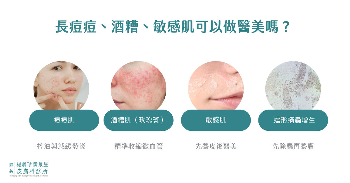 長痘痘、酒糟、敏感肌可以做醫美嗎？