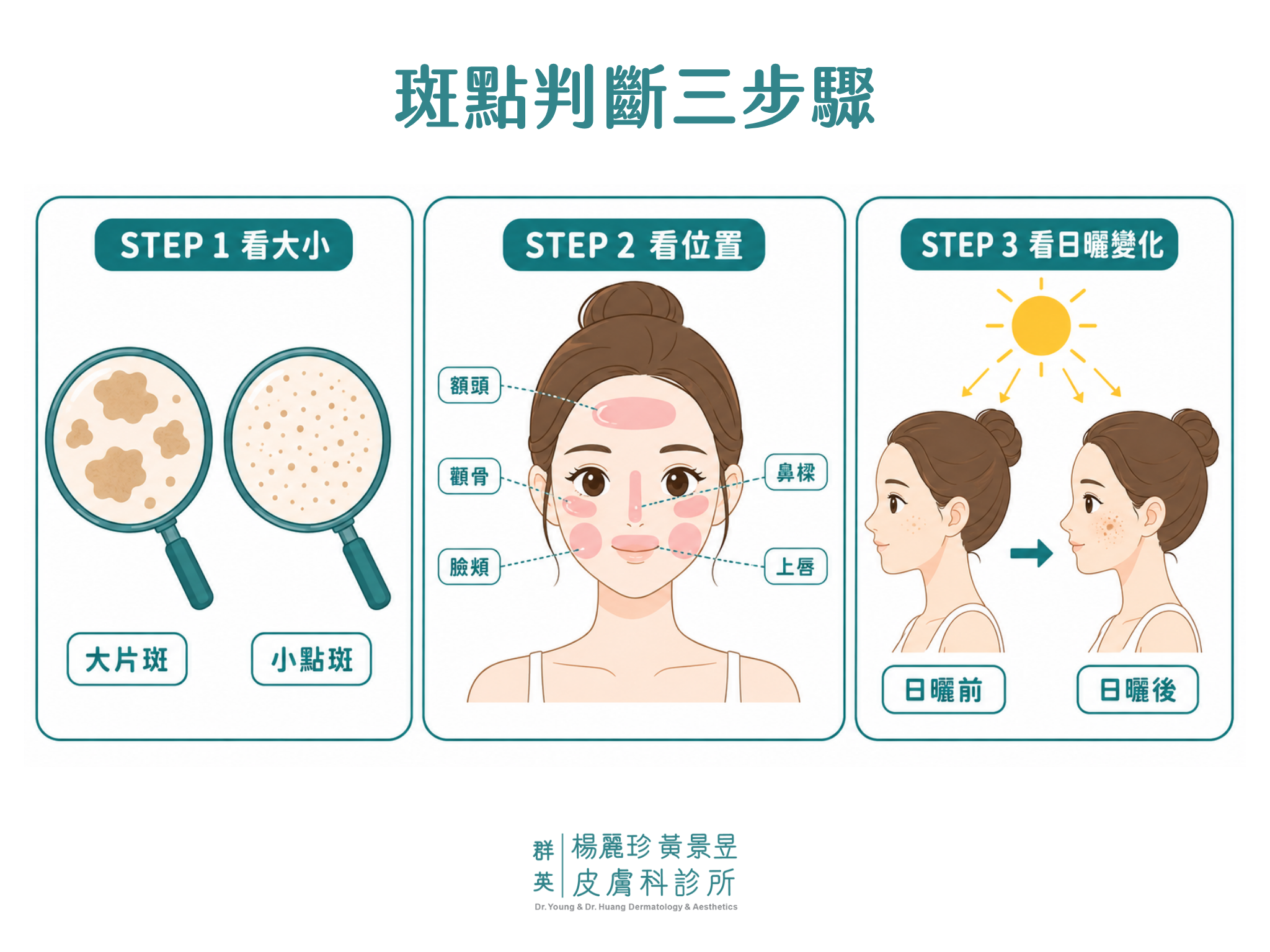 斑點判斷方式步驟圖