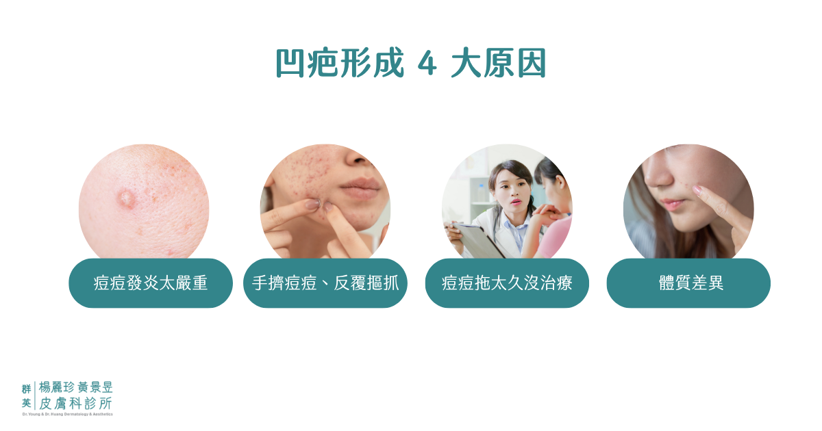 凹疤形成原因