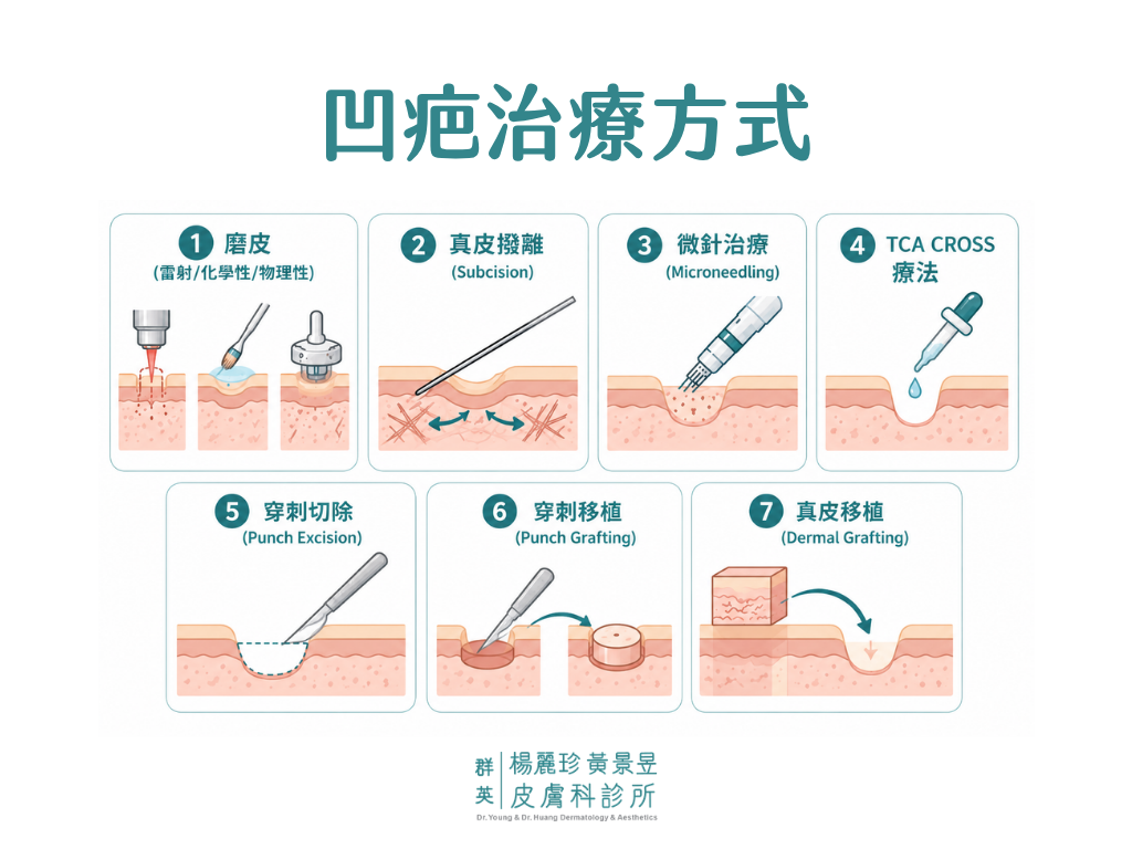 凹疤治療方式示意圖