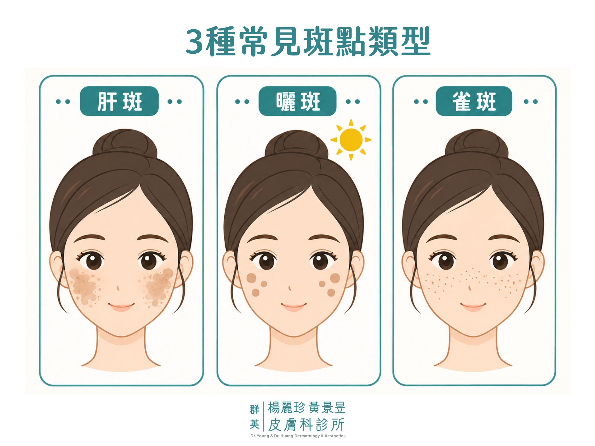 常見的斑點類型示意圖