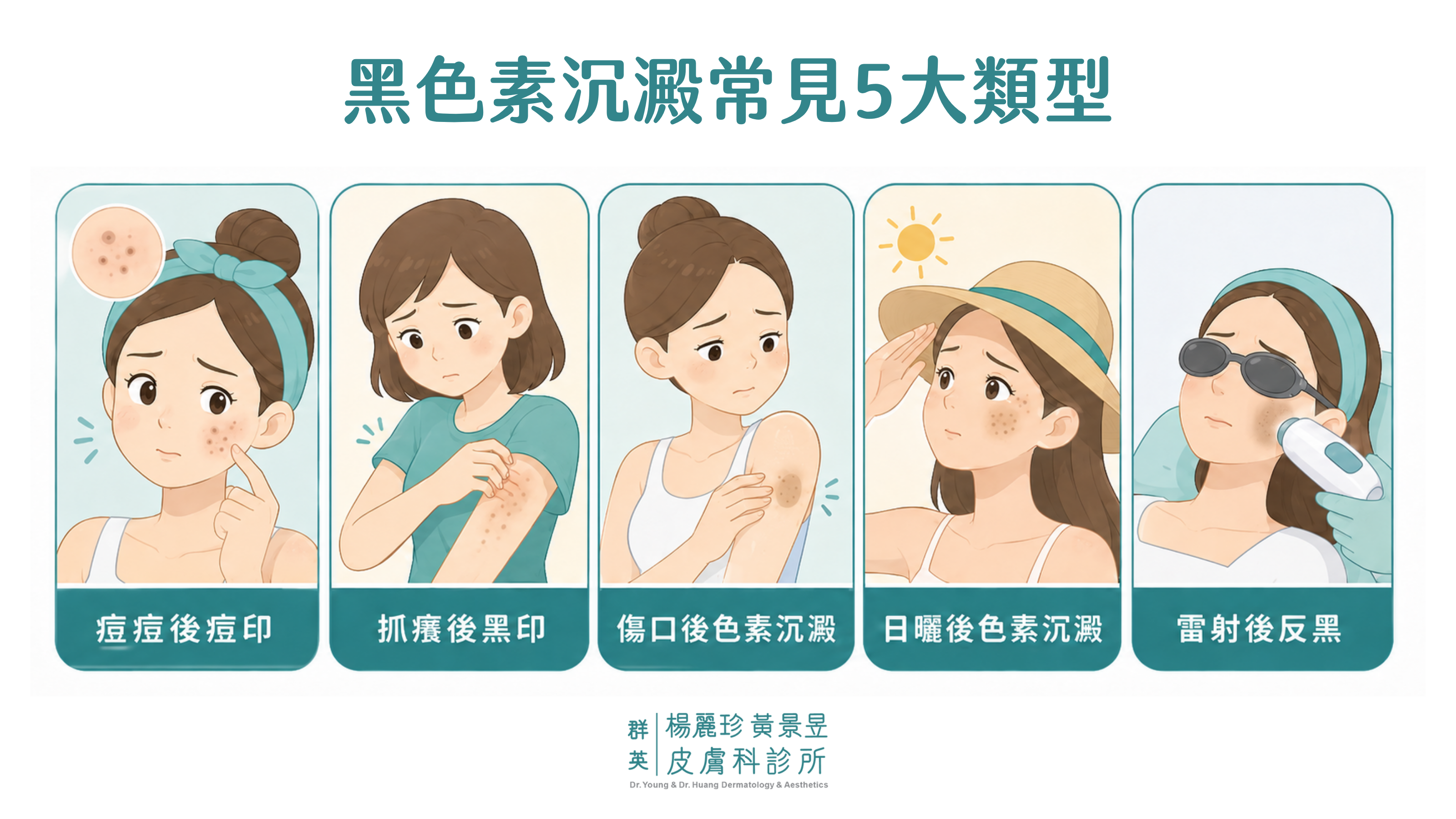 黑色素沉澱類型