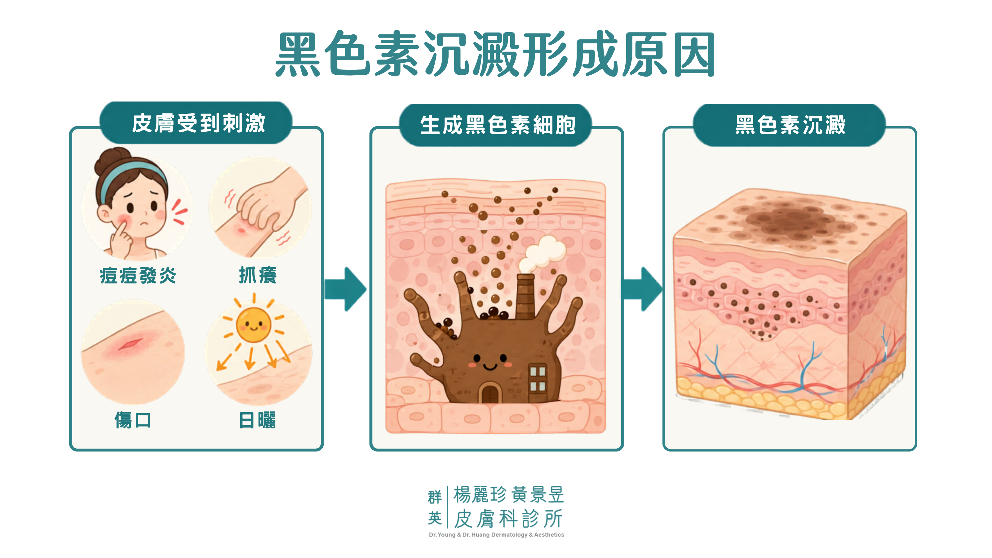 黑色素形成過程
