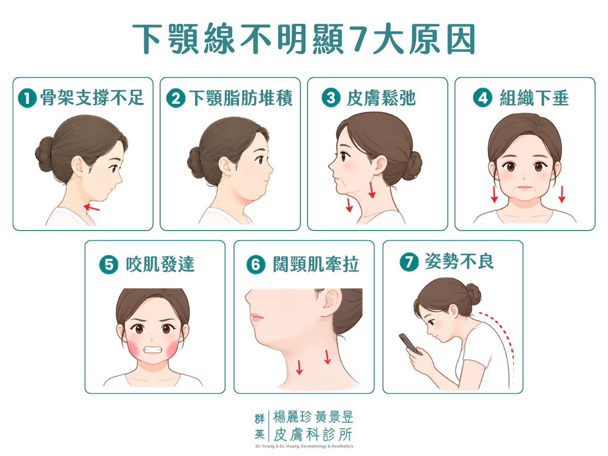 下顎線不明顯原因圖解，整理骨架、脂肪、鬆弛、肌肉與姿勢等 7 大因素