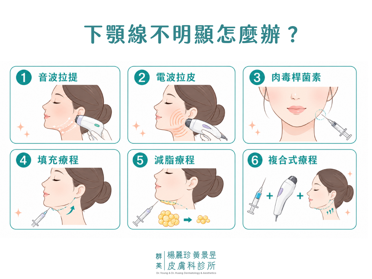 6 種下顎線醫美方式圖解：音波拉提、電波拉皮、肉毒桿菌素、填充療程、減脂療程與複合式療程