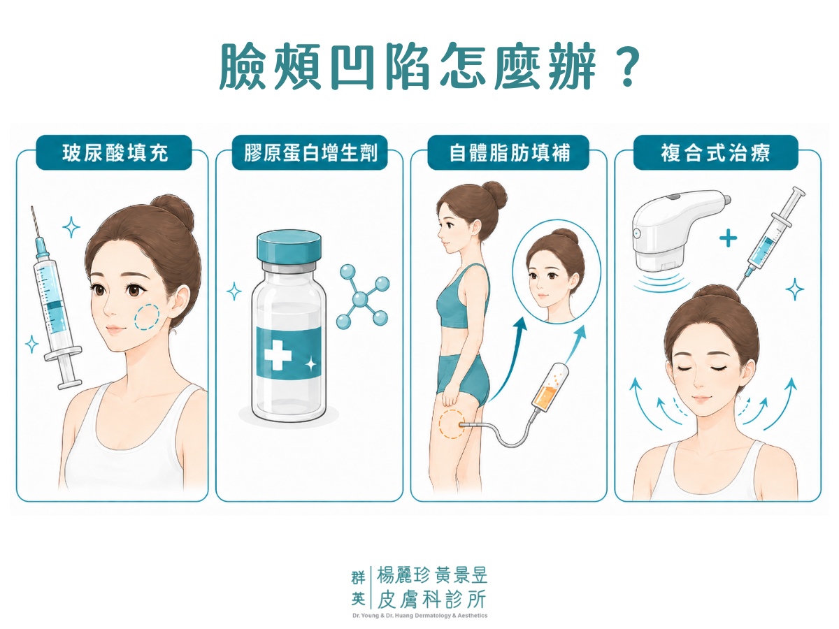 4種臉頰凹陷醫美改善方式圖解