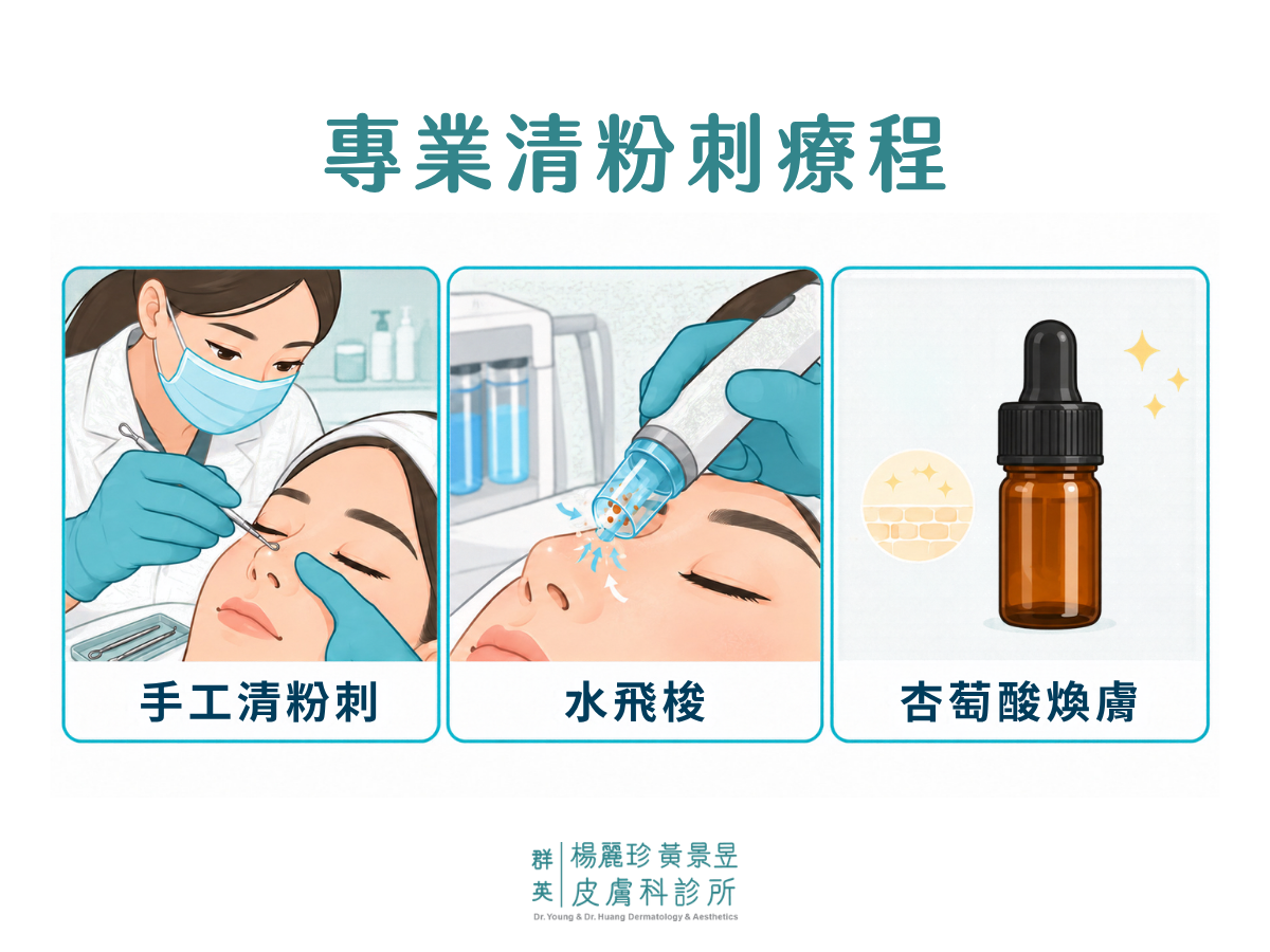 3 種專業清粉刺療程示意圖：手工清粉刺、水飛梭與杏萄酸煥膚。