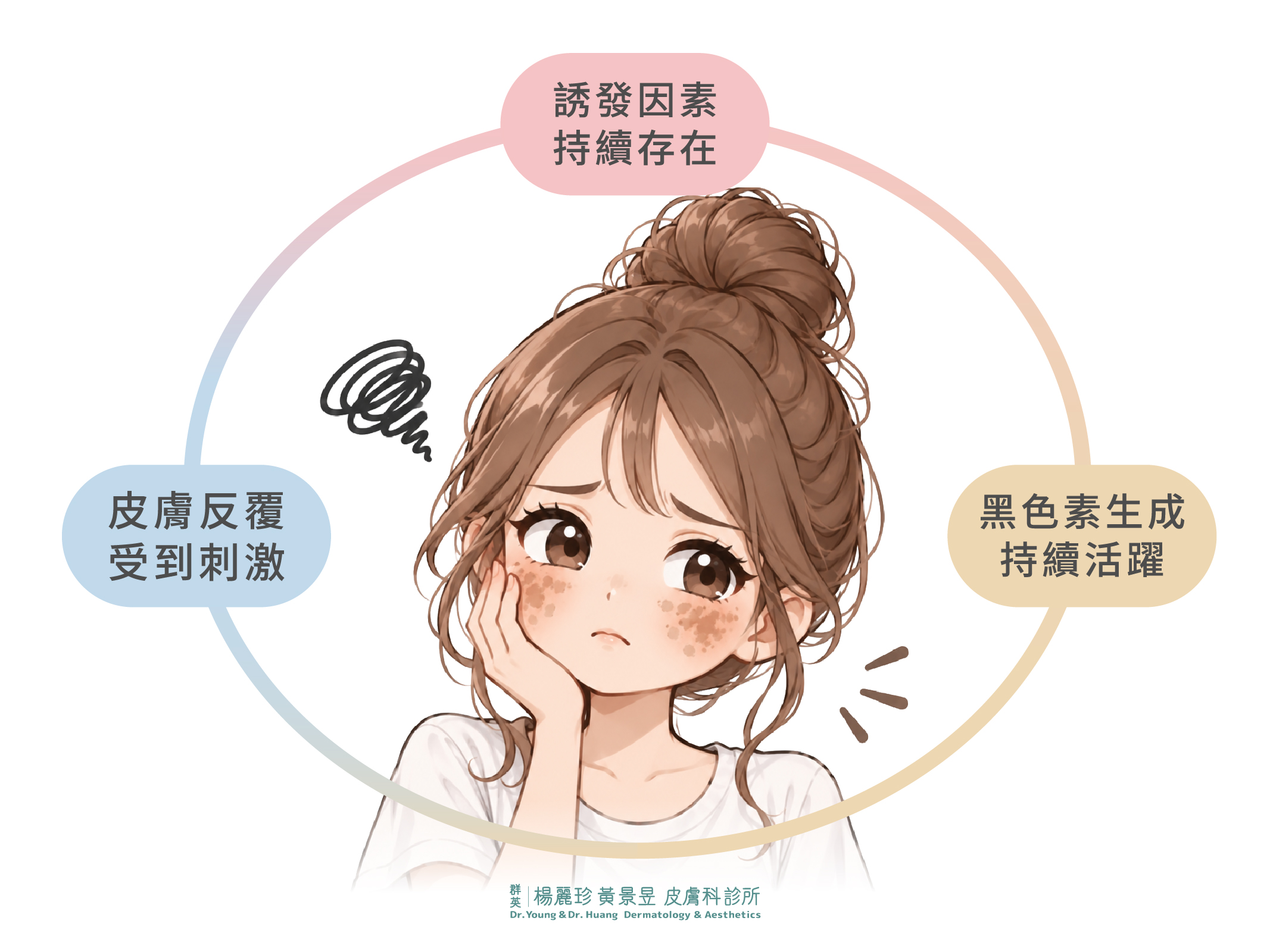 肝斑復發是誘發因素持續存在、外在刺激與黑色素活躍交互作用的結果