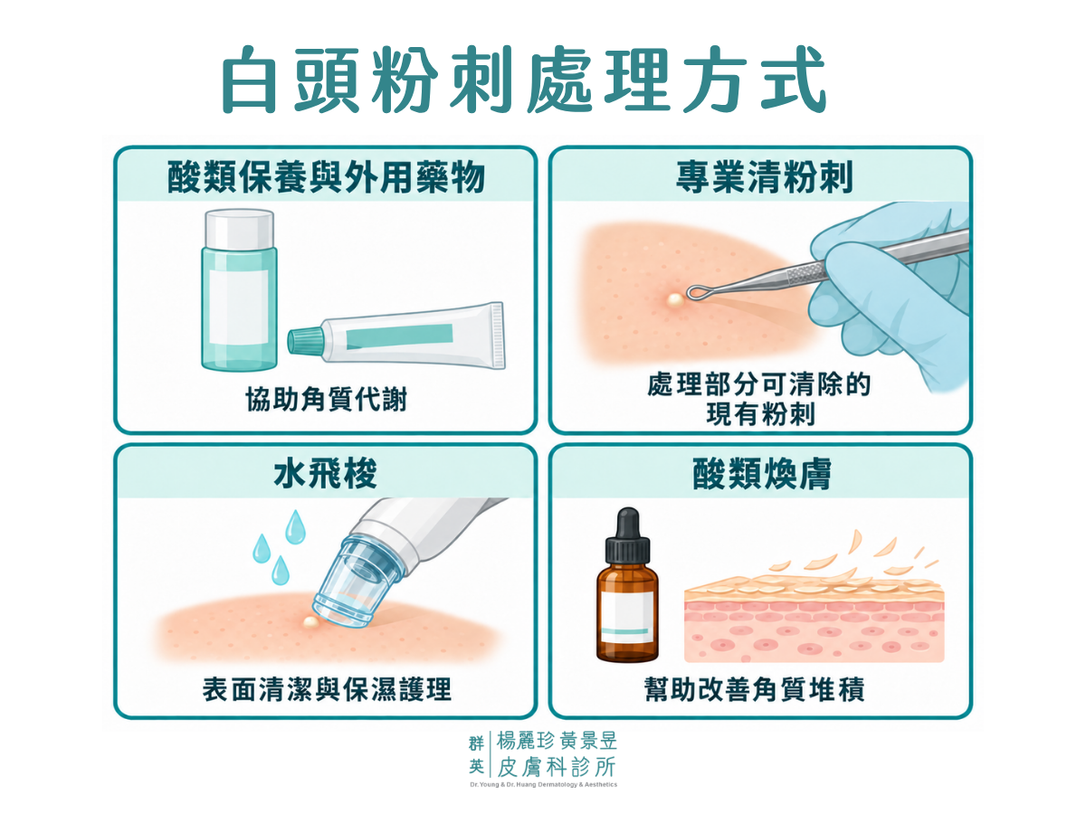 白頭粉刺處理方式：以酸類保養協助角質代謝、尋求皮膚科專業協助，避免自行刺破。